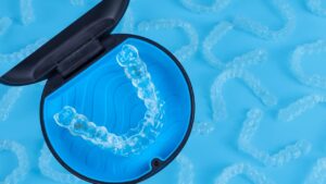 Invisalign Payment Plans